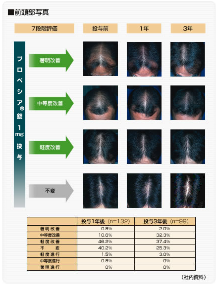 臨床試験データ