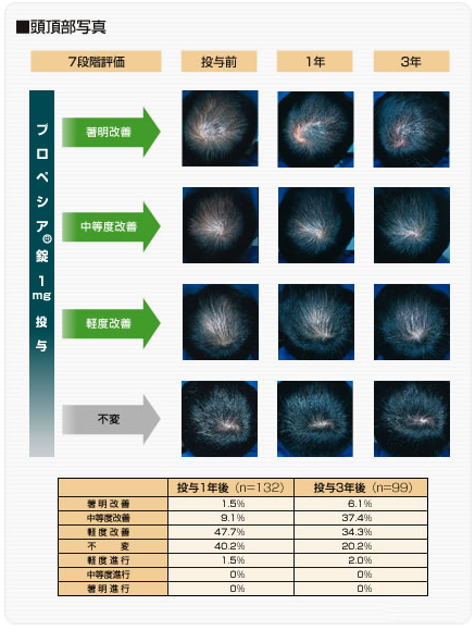 臨床試験データ